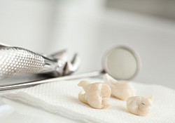 Teeth on a tray after a tooth extraction