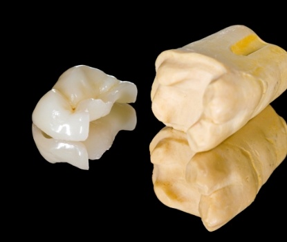 Model tooth with metal free dental crown