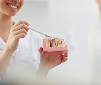 Dentist using model to explaining dental implant tooth replacement