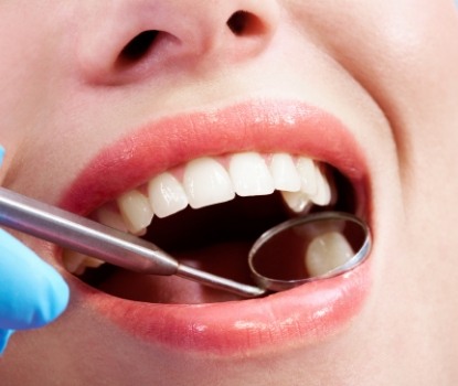 Dentist examining smile with tooth colored filling